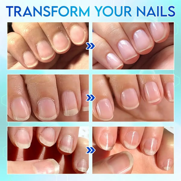 Universal Automatic Fingernail Grinder For Adults And Children
