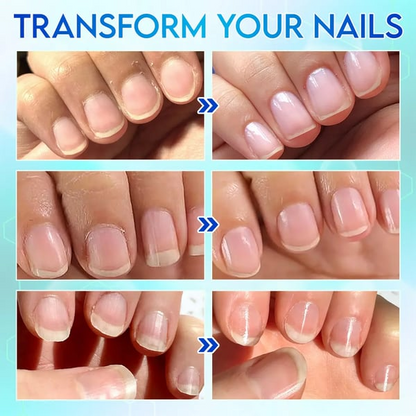 Universal Automatic Fingernail Grinder For Adults And Children