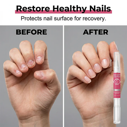 Nail Biting Prevention For Kids & Adults